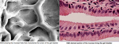 The picture shows the folds of the gall bladder epithelium, and the second 
picture below shows that the gall bladder epithelium is simple columnar. These simple columnar epithelial cells contain microvilli, but it is NOT a microvilli brush borde...