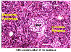 The pacreas is an exocrine and endocrine organ. 90% of the pancreas functions as an exocrine organ, releasing digestive enzymes via acinar cells. 

10% of the pancreas has endocrine functions and releases hormones into the blood stream via Islet...