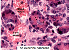 Centroacinar cells (black arrows) produce a 
bicarbonate solution that gets added to the digestive enzymes in the acinous. This helps reduce the acidity of the chyme, bringing the pH of the exocrine pancreas fluid up to 8.