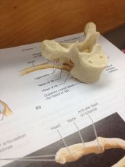 which vertebrae is this