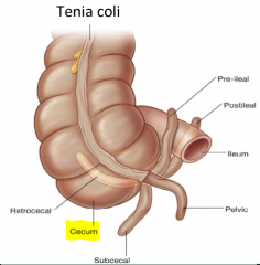 Base of the appendix attaches to the inferior aspect of the caecum where the 3 tenia coli meet

Orientation and size of appendix variable between people