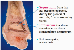 involucrum = dense collar of reactive bone encapsulating the cavity that contains necrotic material
sequestrum = mummified necrotic bone surround by exudate