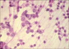 cytology, ovary