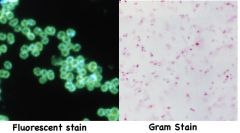 fluorescent stain vs. gram for n. gonorrhea