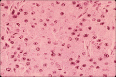 what, ihc, histochemical stain