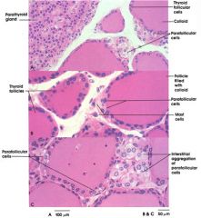 Parafollicular C cells (NOT thyroid follicular cells)