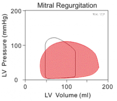 - There is no point in time when both mitral and aortic valves are completely shut
- Therefore, there are no iso-volumic parts of curve
- LV volume gets higher because more blood is staying  in heart (original blood to get pumped into LV + blood...