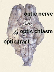 The optic nerve , cranial nerve II, transmits visual information to occipital cortex. Axons caudal to the intersection, called the optic chiasm, are optic tract fibers.