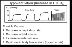 An increase in EtCO2 from previous levels; 

Possible Causes:
- decrease in RR (hypoventilation)
- decrease in Vt (hypoventilation
- increase in metabolic rate (fever, exercise,...)
- rapid rise in temperature (Malignant Hyperthermia)
