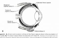 The Tenon capsule (fascia bulbi) is the principal orbital fascia and forms the envelope
within which the eyeball moves (Fig 2-6/\). The Tenon capsule fuses posteriorly with the
optic nerve sheath and fuses anteriorly with the intermuscular septu...