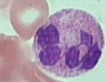 Identify this cell