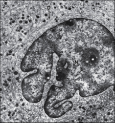 They are mature megakaryocytes that have numerous invaginations of plasma membrane ramifying throughout the cytoplasm
This membrane system (D) is a reservoir of membrane used during elongation of the numerous proplatelets which extend from the me...