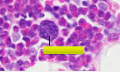 Identify this cell