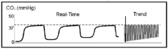 Elevation of the baseline indicates rebreathing (may also show a corresponding increase of EtCO2)

Possible causes: 
- faulty expiratory valve
- inadequate inspiratory flow
- malfunction of a CO2 absorber system
- partial rebreathing circuits
- ...