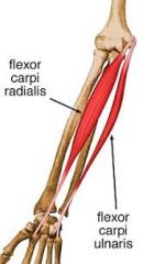 humeral head: common tendon from medial epicondyle


 


ulnar head: olecranon process and proximal 2/3 of posterior bordder