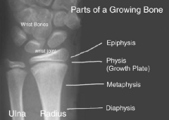 Physis (growth plate) between the metaphysis and epiphysis

This is where most fractures occur