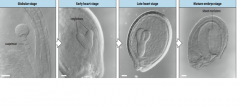 Embryogenesis covers development from the time of fertilization until dormancy occurs.
1. Establish the basic body plan.
Radial patterningproduces three tissue systems, and
axial patterningestablishes the apical-basal (shoot-root) axis.
2. Set asi...