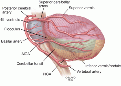 1. Superior cerebellar artery supplies the superior hemispheres and vermis, the rostral aspect of the dentate nucleus, and the remaining deep nuclei
2. Posterior inferior cerebellar artery sipplies the lateral medulla and inferolateral surface of ...