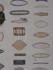 Name these organisms. Name their phylum. What is their cell wall made of? What is the word for these bilaterally shaped diatoms?