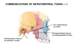 What nerve exits the Peterotempanic fissure?