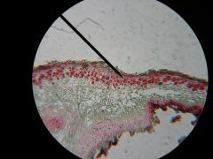 Name these red cells on the lichen slide. Name the green part of this lichen slide.
