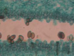 Name the phylum and genus. Point out the basidium and basidiospores. Name this reproductive layer.