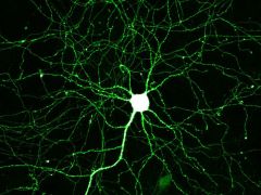 This area of the neuron branches out into a structure that is known as a dendritic tree.