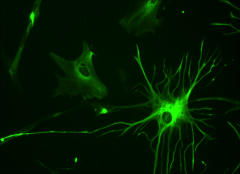 Restricted to the CNS, have elaborate local processes that give these cells a starlike appearance, maintain chemical environment for neuronal signaling. What glia cell am I?