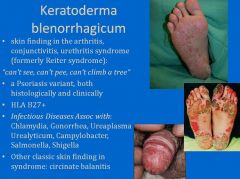 Keratoderma blenorrhagicum