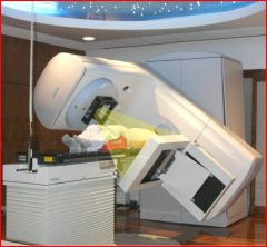 What is External Beam Radiation Therapy?