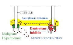You can provide dantrolene, which blocks the release of Ca++ from the sarcoplasmic reticulum.