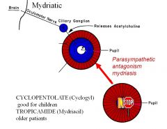 Cyclopentolate (for children)
Tropicamide (for older patients)