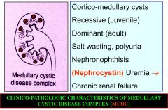 Medullary cystic disease complex.