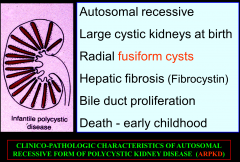 Autosomal Recessive form of Polycystic Kidney Disease