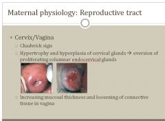Hypertrophy and hyperplasia of cervical glands leading to eversion of proliferating columnar endocervical glands.