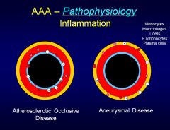 For anureysms, the inflammation is out in the adventitia, while for occlusive disease, the inflammation is in the lumen/intima.