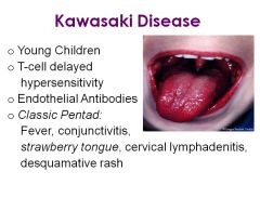 •	Kawasaki disease; occurs in children 2-5
•	T-cell delayed hypersensitivity
•	Endothelial Antibodies
•	Classic Pentad
o	Fever
o	Conjunctivitis
o	Strawberry tongue
o	Cervical lymphadenitis
o	Desquamative rash
•	Untreated: risk of coronary artery 