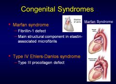 Marfan’s is an inherited connective tissue disorder with a defect in fibrillin. 98% have cardiovascular defects.
Ehlers-Danlos is a congenital defect in type III procollagen.