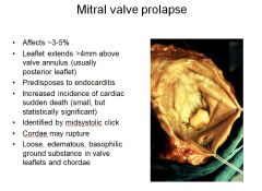 Mitral valve prolapse is a common congenital lesion (up to 5% of the population) and the leading cause of MR in the USA.
