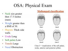 The Mallampati classification is used by anesthesiologists to grade how easy it would be to insert a breathing tube into a patient. It’s also used to determine risk for OSA.
