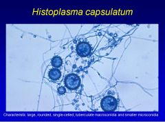 •	Histoplasmosis; you also get:
•	Mediastinal lymphadenitis
•	Cavitary pulmonary histoplasmosis
•	Progressive disseminated histoplasmosis (PDH)
What’s the typical initial immune/inflammatory response to blastomycosis?
Clusters of neutrophils and nonc