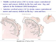 •	Middle cerebral artery (MCA) stroke causes contralateral motor and sensory deficits in the (face and arm) > leg, and aphasia in the dominant (left) hemisphere.
•	Anterior cerebral artery (ACA) stroke causes contralateral motor and sensory deficits in t