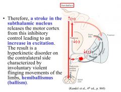 The subthalamic nucleus constitutively inhibits the cortex, thus a stroke in the subthalamic nucleus would cause an increase in excitation, resulting in hyperkinetic disorder on the contralateral side characterized by violent flinging movements of the lim