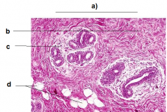 a) Connective Tissue
b) Dense irregular connective tissue
c) Loose connective tissue
d) Adipocytes
