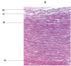 A) Elastic Artery (large artery)
b) Endothelium
c)Tunica Intima (no internal elastic membrane)
d) Tunica Media (contains elastic lamellae)
d) Tunica Adventitia