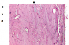 A) Compact bone, long bone
b) periosteum
c) osteocyte
d) osteoclast