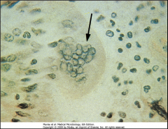 What type of CPE (cytoplasmic inclusion) is pictured here?

What virus is this sample from?