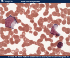 1. Name the abnormal cell and the causative intruder.
2. What chromosomal mutation causes this?
3. What causes the hyperproliferation of B-cells?