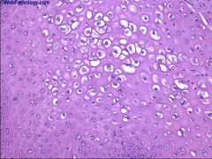 1. What is pictured above and what virus causes it?
2. What is the histological description of the pictured cells?
