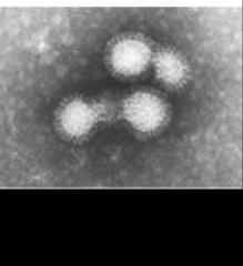 1. What is this and what causes it?
2. What is the morphology?
3. Where does this virus replicate?